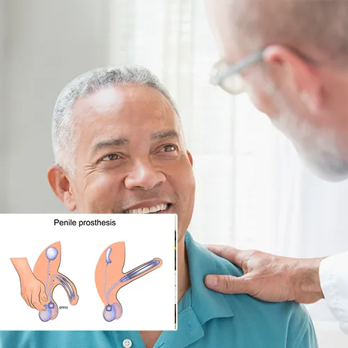 Why Choose  Greater Long Beach Surgery Center

for Your Penile Implant?
